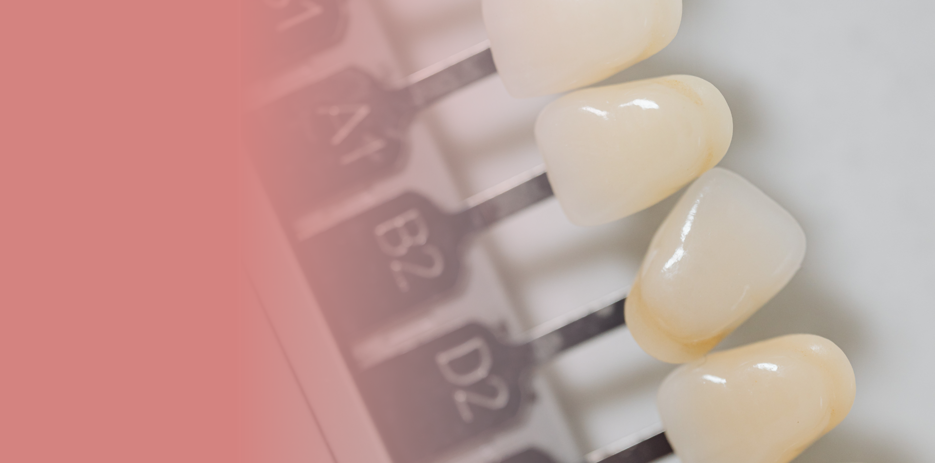Dental Health Studio – Clinica Dental Tijuana